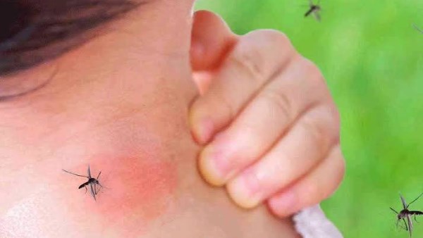 فلوريدا تفرض طوارئ محلية بعد تسجيل إصابات قياسية بحمى الضنك