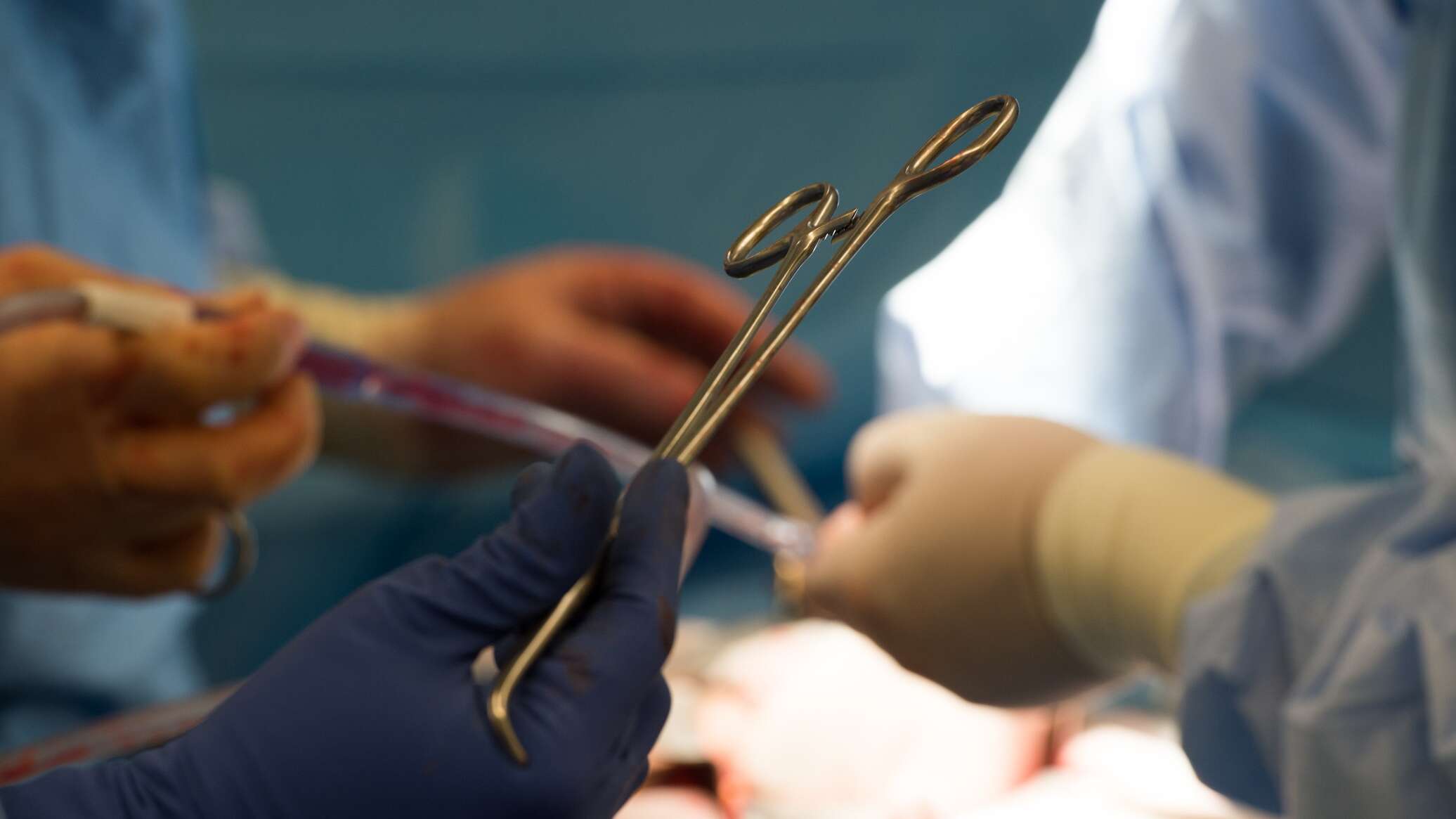 تونس.. تسجيل مئات الأخطاء الطبية سنويا وأكثرها في طب التجميل