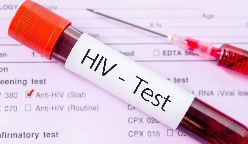 ما هو تحليل HIV فيروس نقص المناعة البشرية.. وما هي أنواعه؟