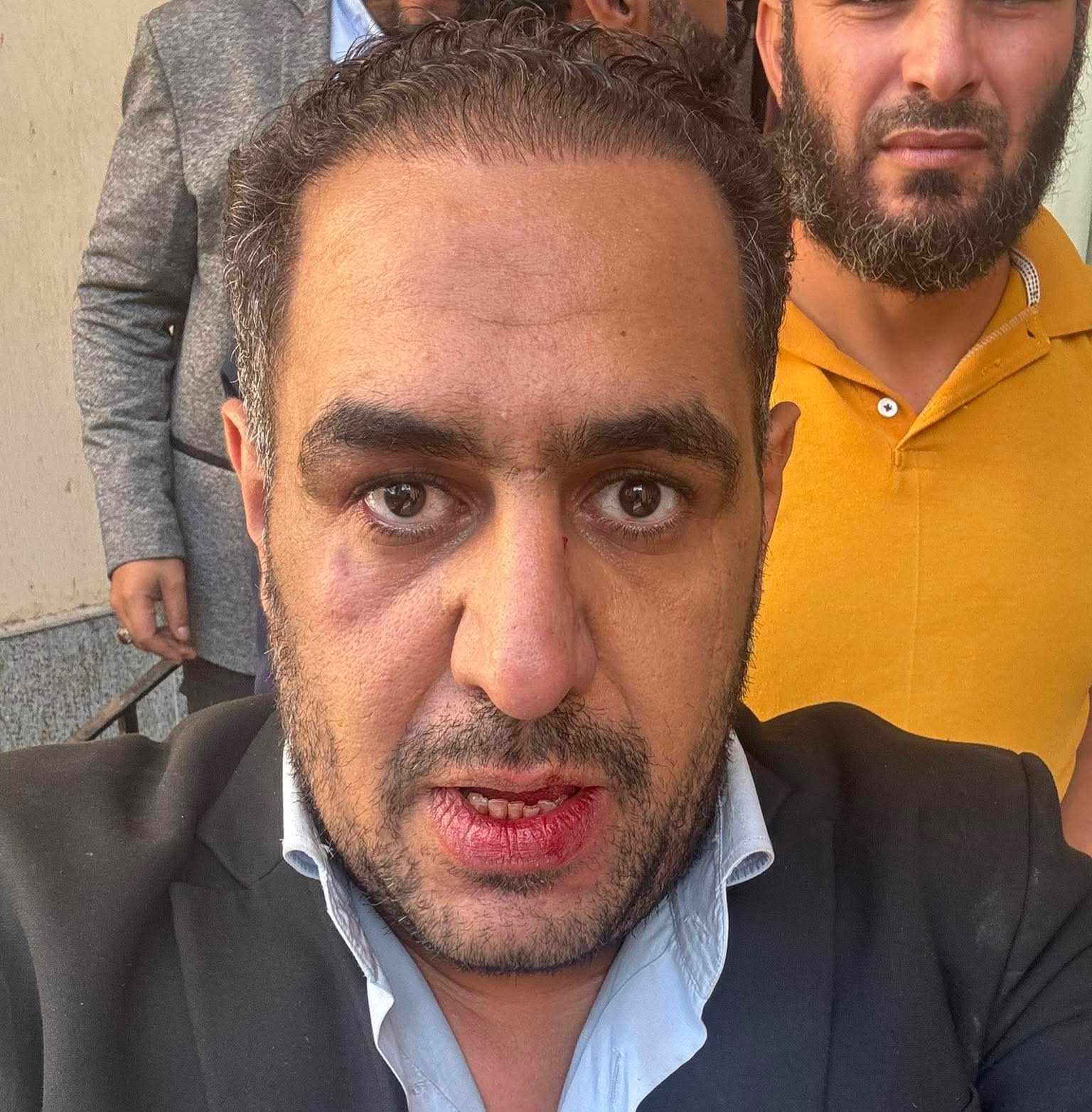 المرشح أحمد عبد ربه يعلق على ما جرى أمام محكمة طنطا: "كنت أول واحد على الباب!"
