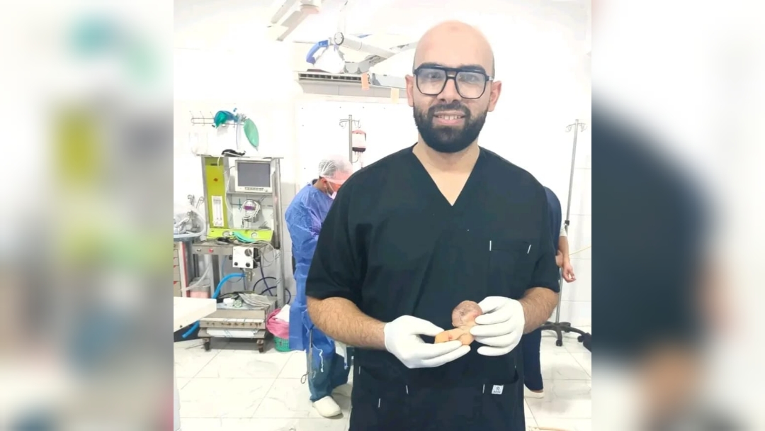 إنقاذ رضيع بالشرقية بعد جراحة نادرة لاستئصال جنين داخل جسده امتد إلى الصدر