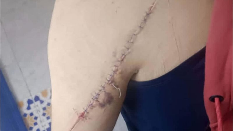 خلافات زوجية تنتهي بطعن شاب على يد زوجته في الشرقية