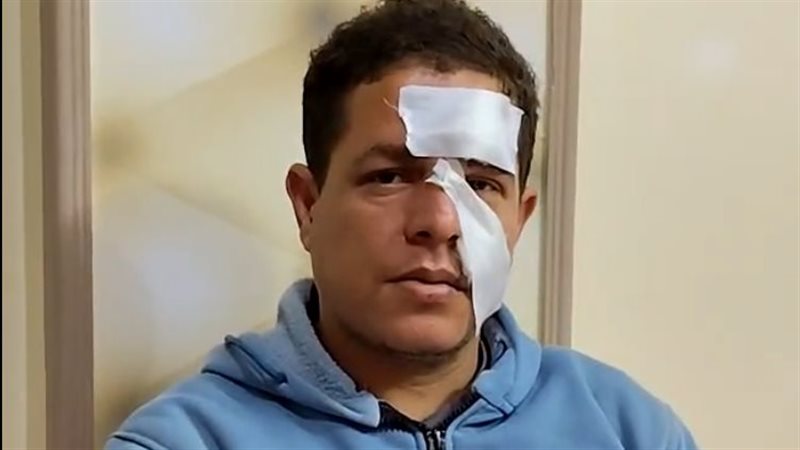 اعتداء طالب على معلم بالدقهلية يُشعل الغضب.. والمعلم يُصاب بـ15 غرزة داخل الفصل